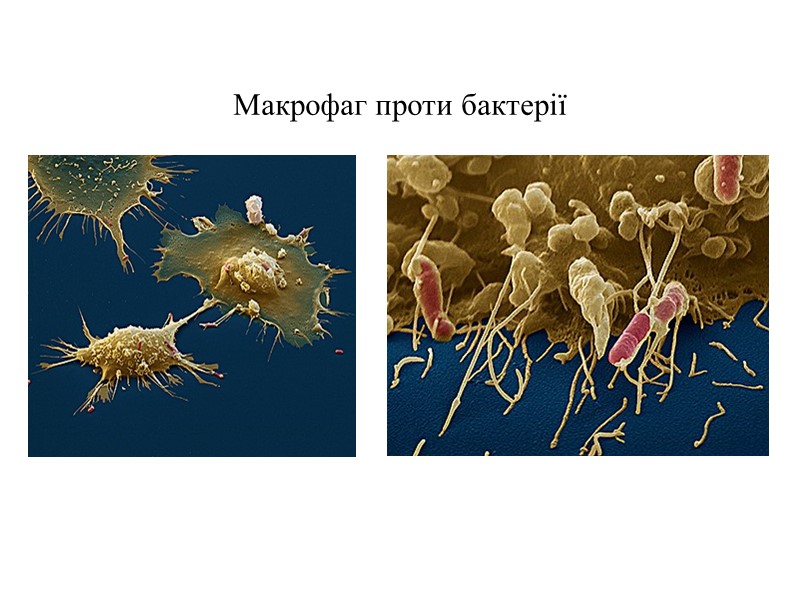 Макрофаг проти бактерії